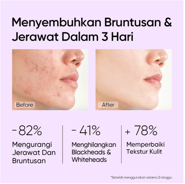 SKINTIFIC Cosmetics SKINTIFIC 5% AHA BHA PHA Exfoliating Toner