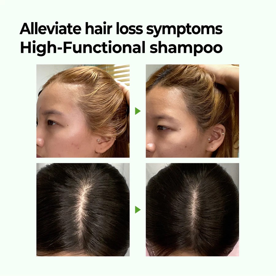 Perennbell SOME BY MI Cica Peptide Anti Hair Loss Derma Scalp Shampoo