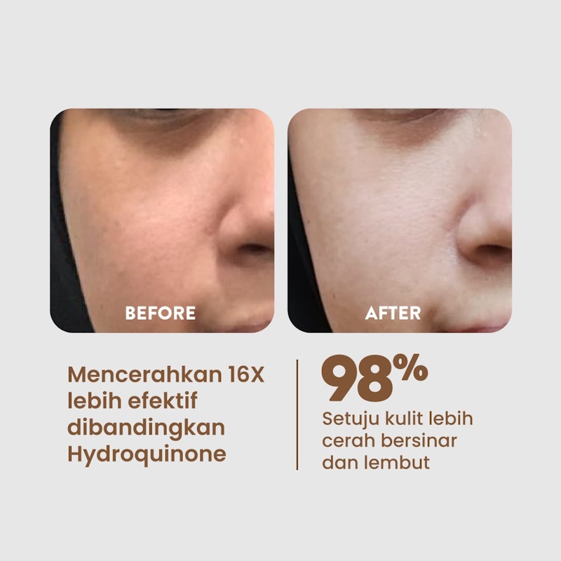 Potion of Light Serum 4