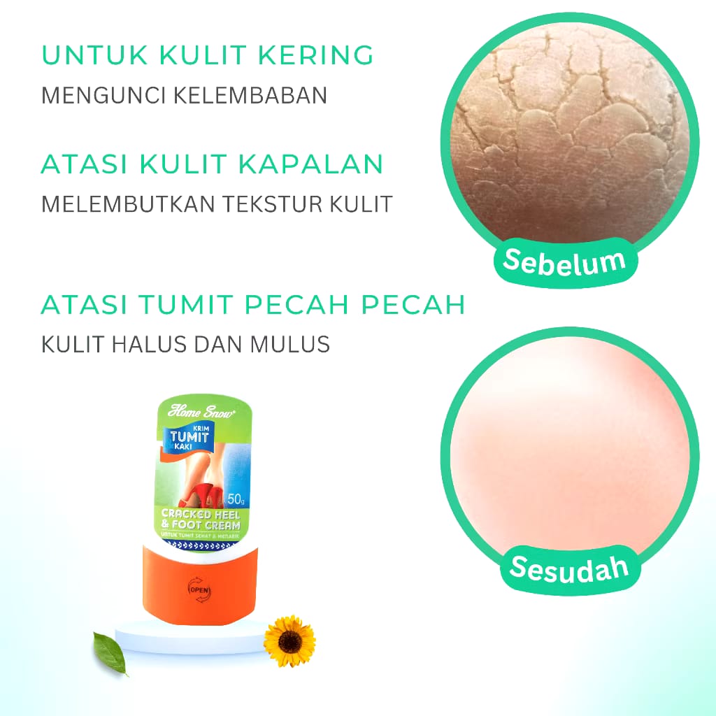 Empat Musim Multi Cantik Home Snow Krim Tumit & Kaki
