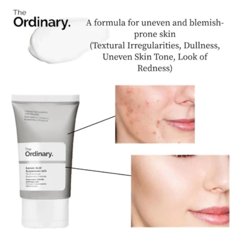 Azelaic Acid Suspension 10% 2