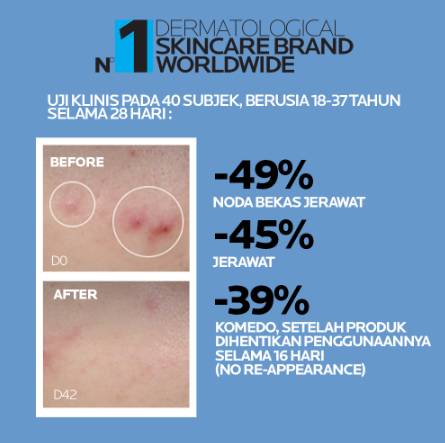 L’Oréal La Roche-Posay Effaclar Ultra Concentrated Serum