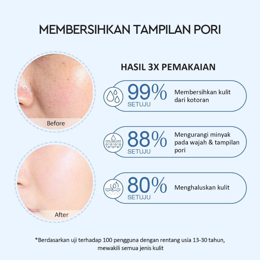  Glad2Glow Volcano 3D Acid Pore Clay Mask