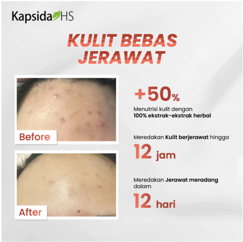 Kembang Bulan Kapsida HS 4