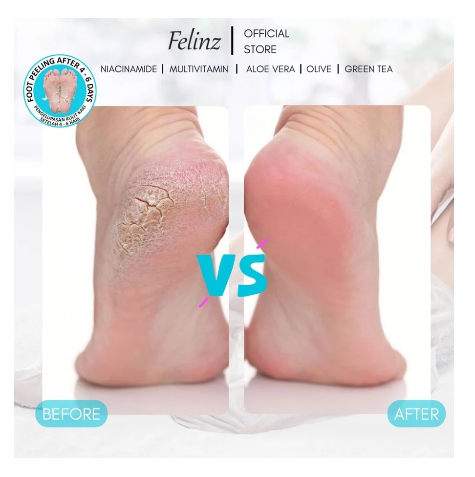 CAKRA DAYA MAKMUR Felinz Exfoliating Foot Mask 
