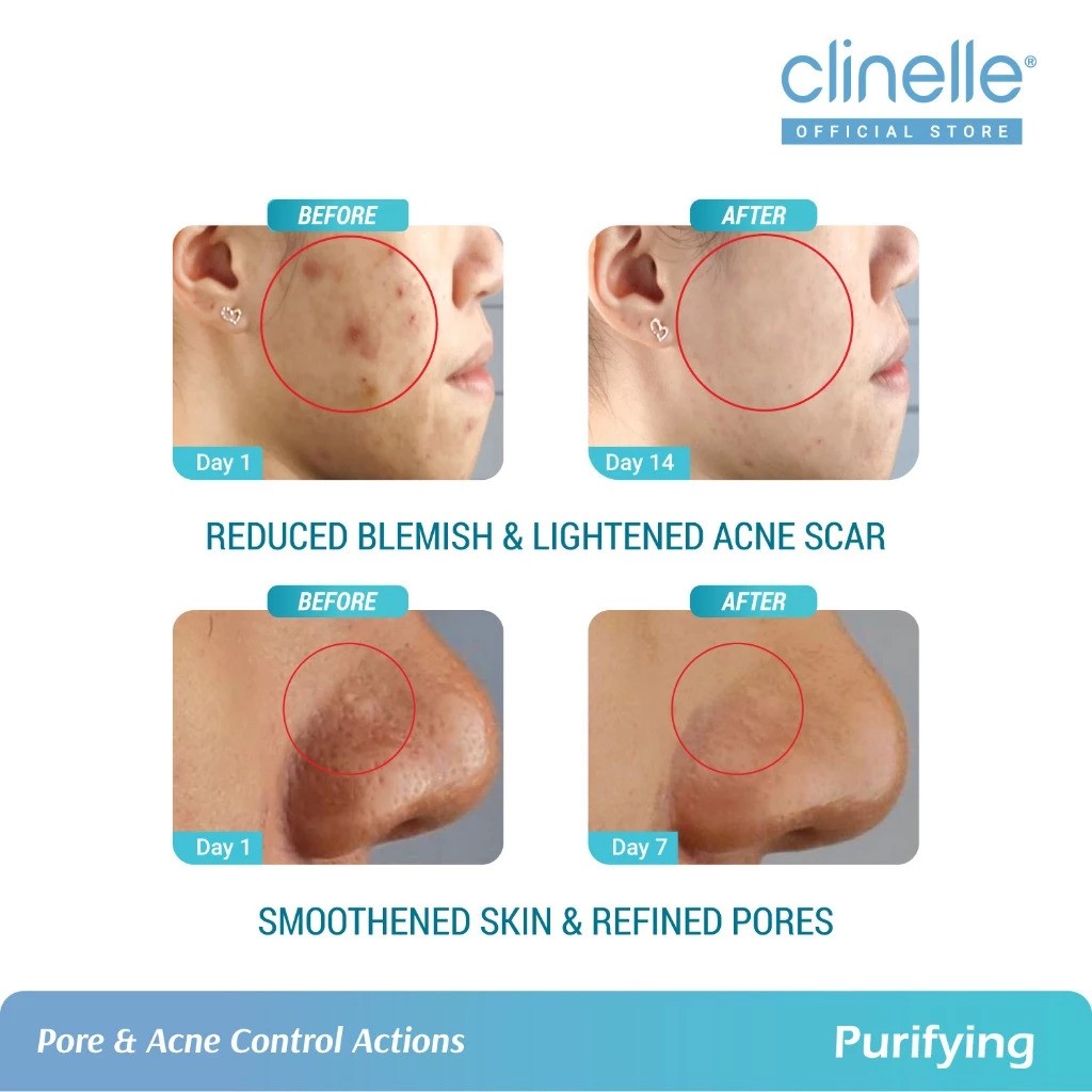 CLINELLE Purifying Pore Minimizer Essence Water 4