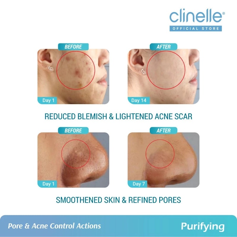 CLINELLE Purifying Pore Minimizer Essence Water 4