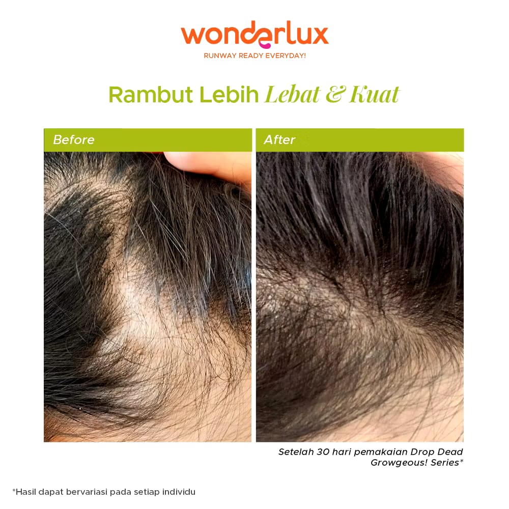 Wahana Kosmetika Indonesia Wonderlux Drop Dead Growgeous! Densifying Hair Growth Shampoo