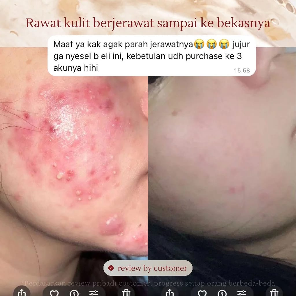 Sheng Hua Long Biotech Eileen Grace Moisturize Rose Jelly Mask