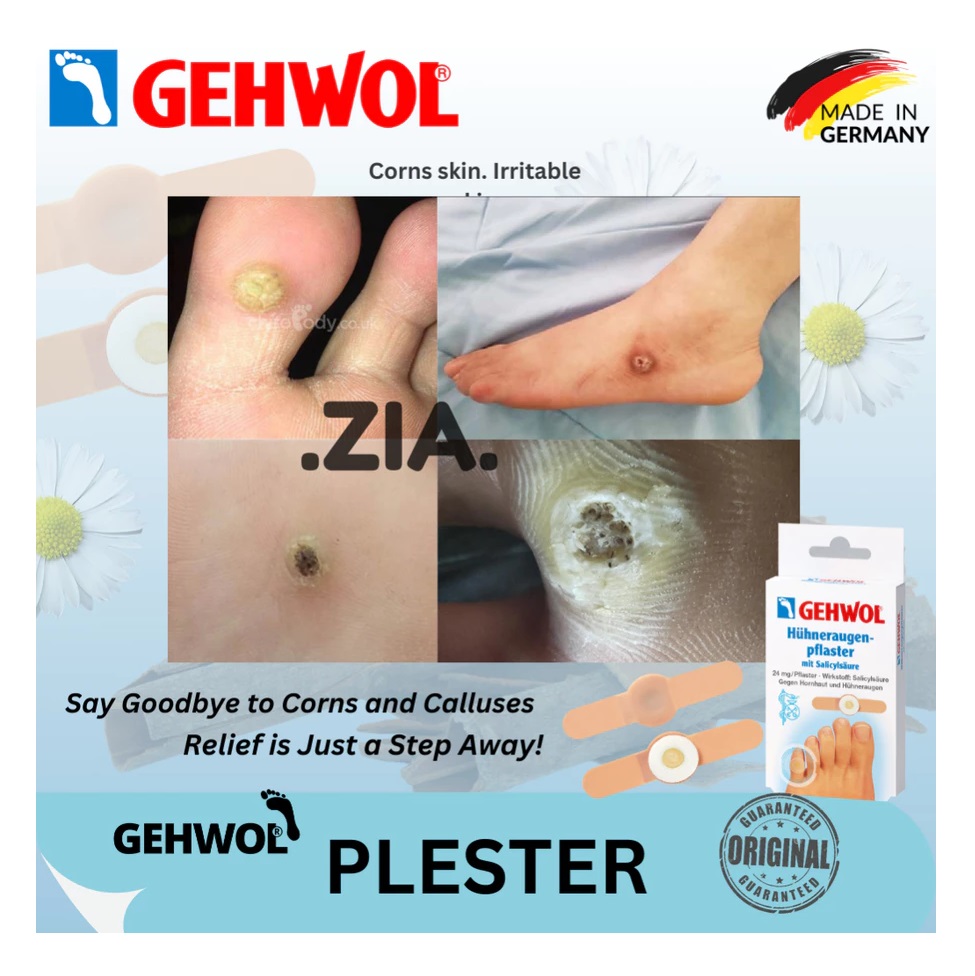  Gehwol Corn Plasters with Salicylic Acid