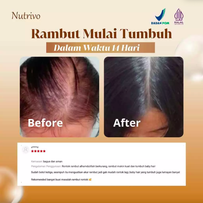 Nutrivo Indonesia Nutrivo Hair Serum With Redensyl