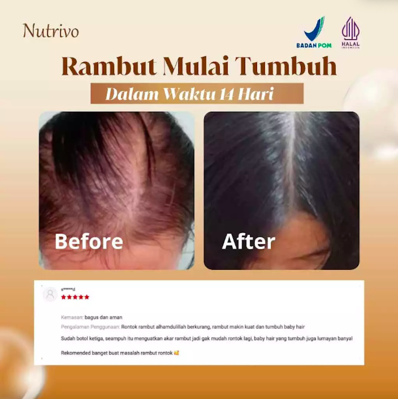 Nutrivo Hair Serum With Redensyl 4
