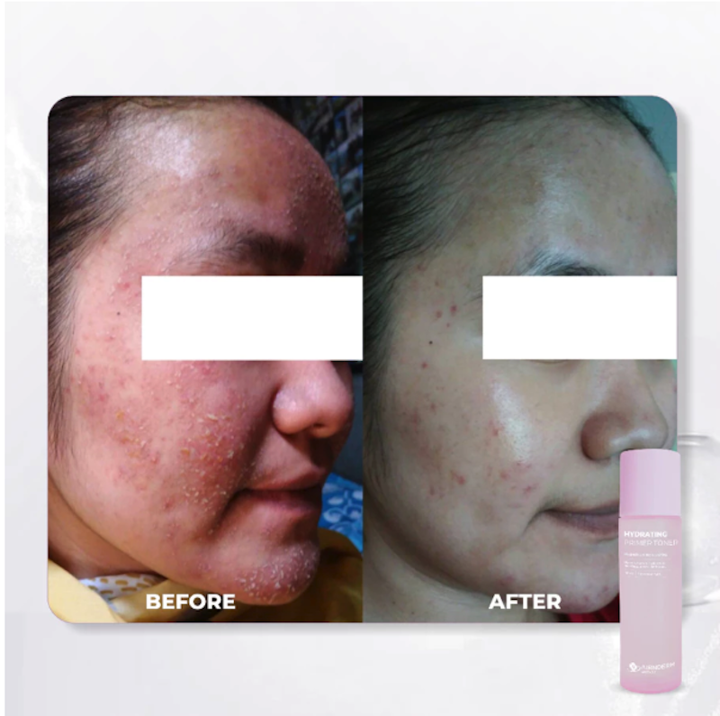 Airnderm Aesthetic Hydrating Primer Toner 4