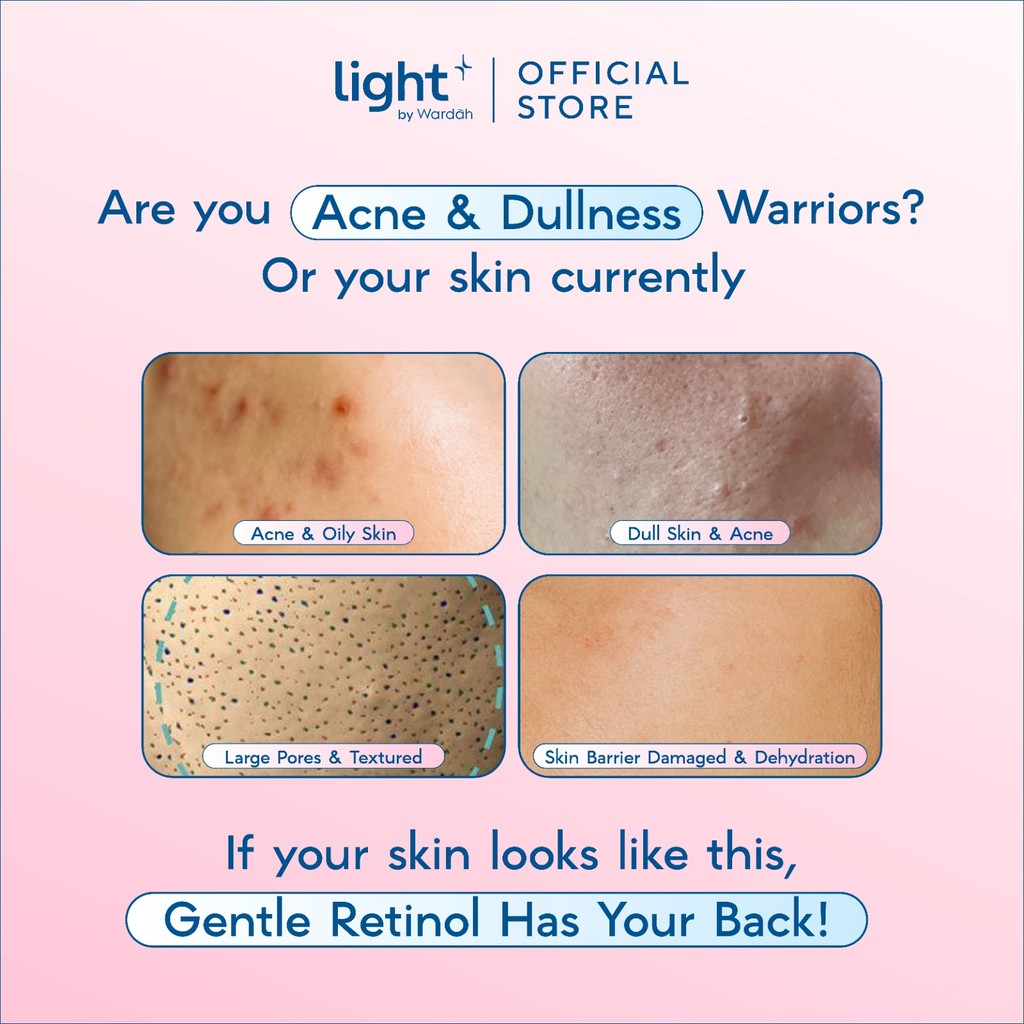 Paragon Technology and Innovation Wardah Light+ HPR Retinoid Bright + Acne Serum Moisturizer