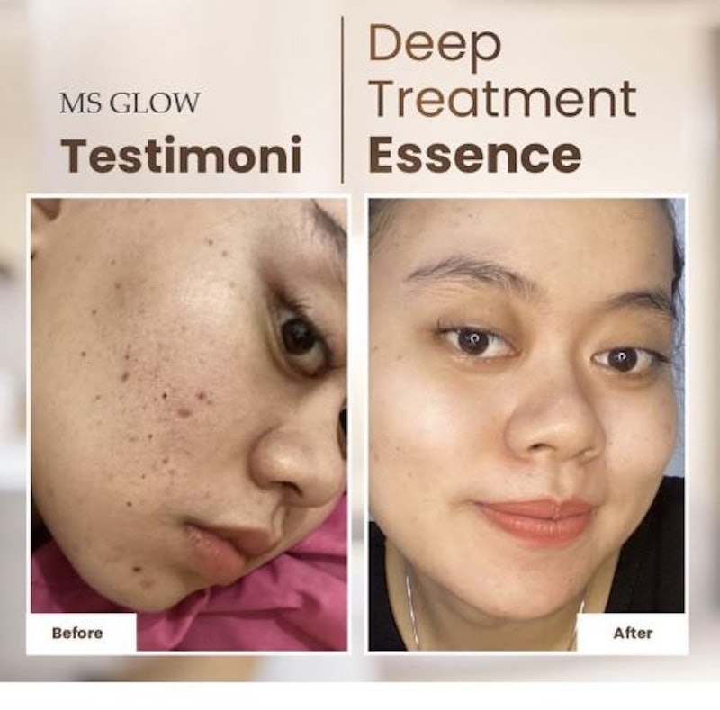 MS Glow Deep Treatment Essence Salmon DNA 3