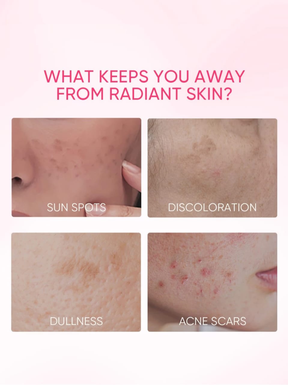 SKINTIFIC COSMETICS SKINTIFIC 10% Niacinamide Brightening Serum