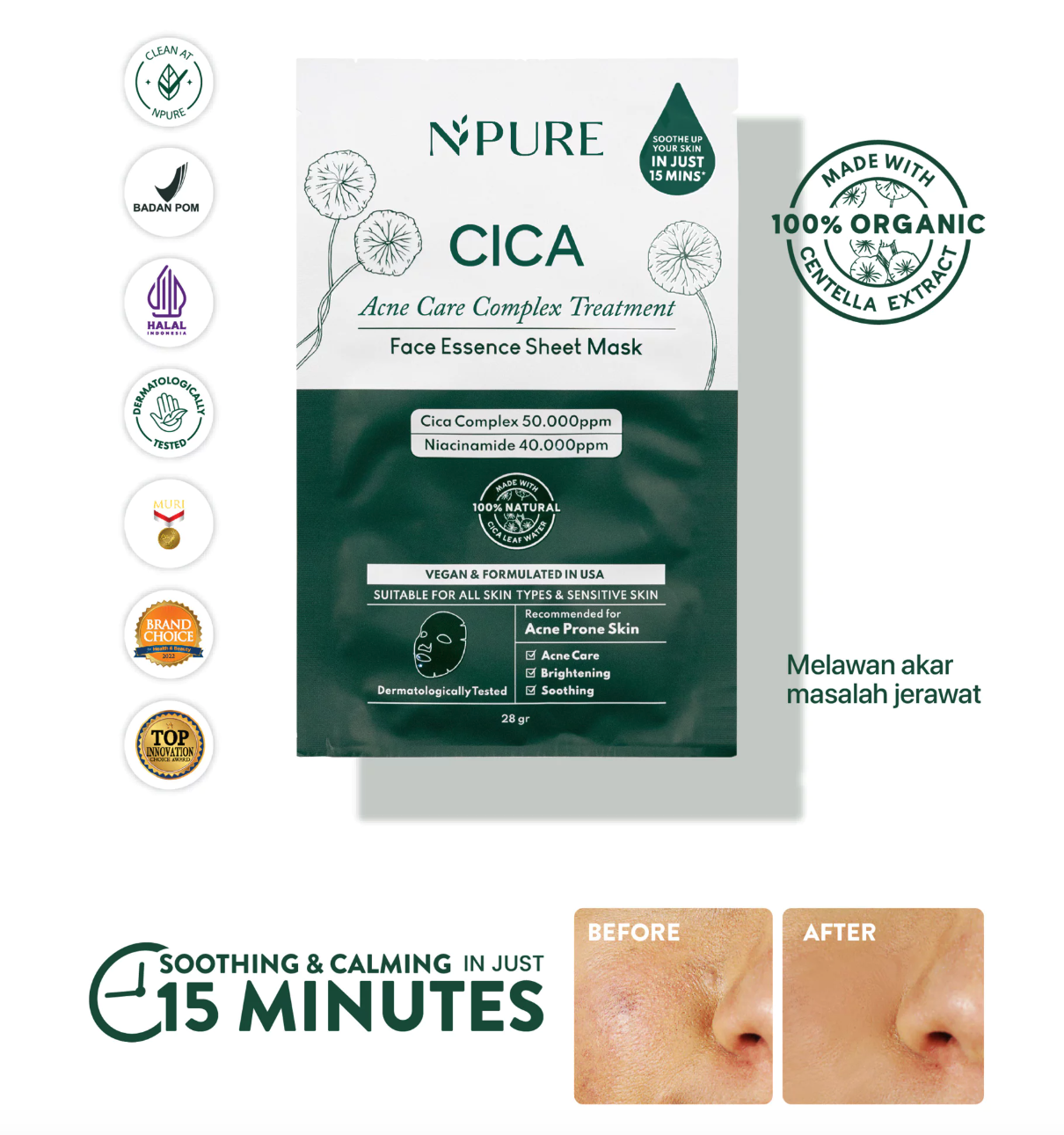 Penta Natural Kosmetindo N'PURE Cica Acne Care Complex Treatment Face Essence Sheet Mask