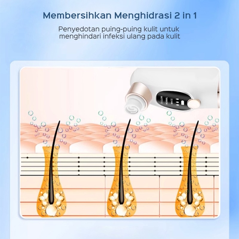 HAN RIVER HAN RIVER Alat Penghilang Komedo B01