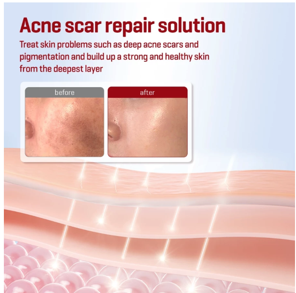 Perennbell SOME BY MI Snail Truecica Repair Toner