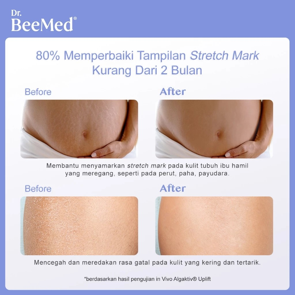 Docbee Deca Indonesia Dr.BeeMed Stretch Mark Cream 