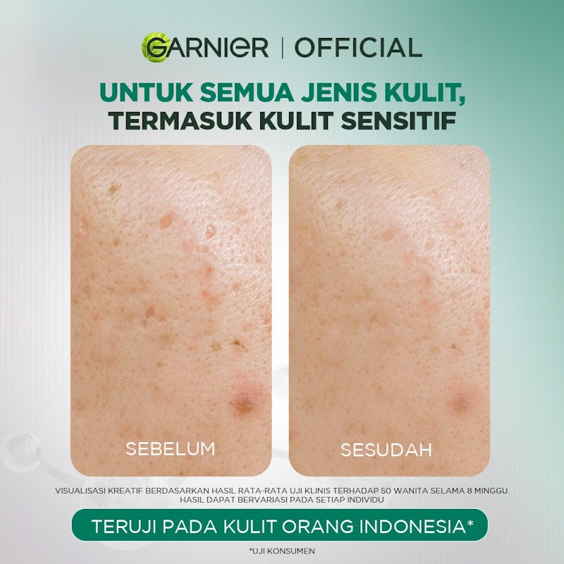 Tri-Acid Renew Peeling Serum 5