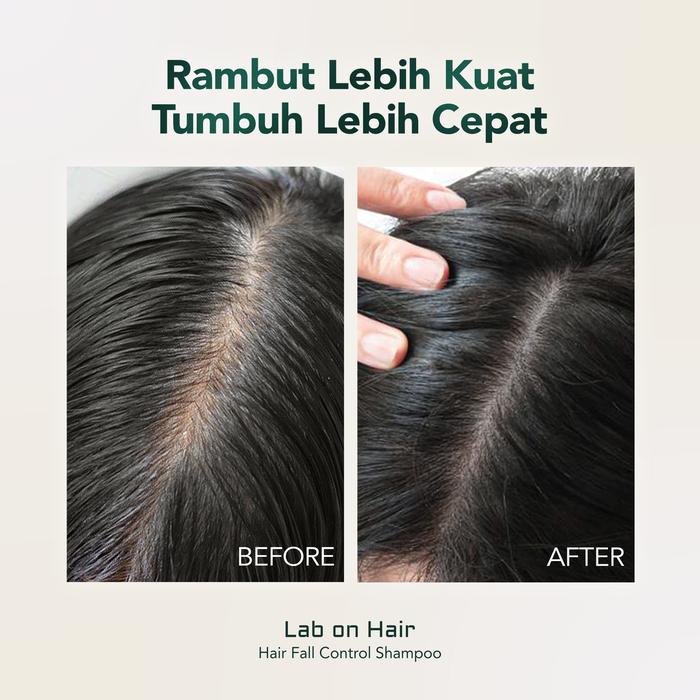 Ayara Beauty Indonesia Lab On Hair Anti Hair Fall Shampoo