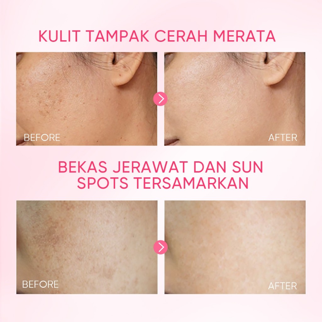 SKINTIFIC Cosmetics SKINTIFIC 10% Niacinamide Brightening Serum