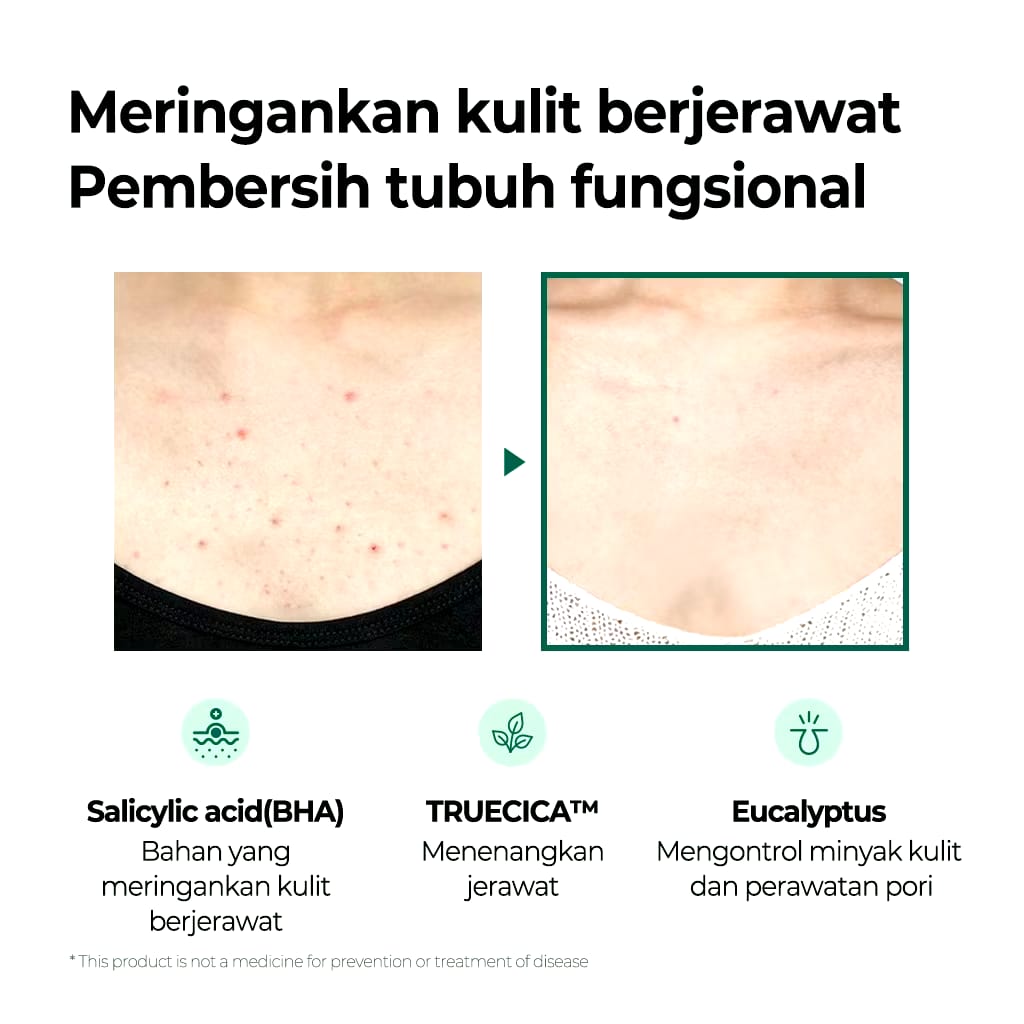 Perennbell SOME BY MI AHA BHA PHA Miracle Acne Clear Body Cleanser 