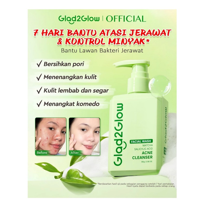 Glad2Glow Matcha Salicylic Acid Acne Cleanser 2