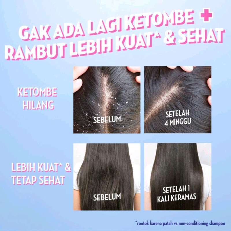 UNILEVER Indonesia Sunsilk Anti-Ketombe Rambut Sehat & Kuat