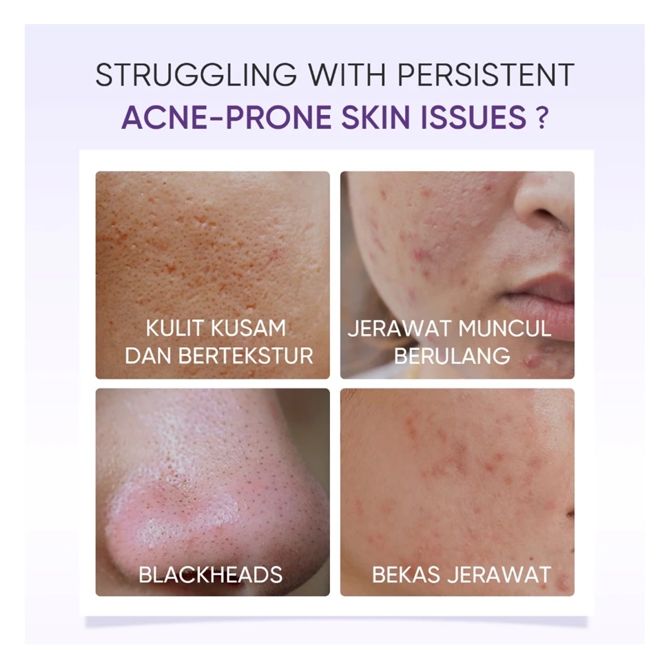 SKINTIFIC Cosmetics SKINTIFIC Lactic Acid Skin Renewal Exfoliating Serum