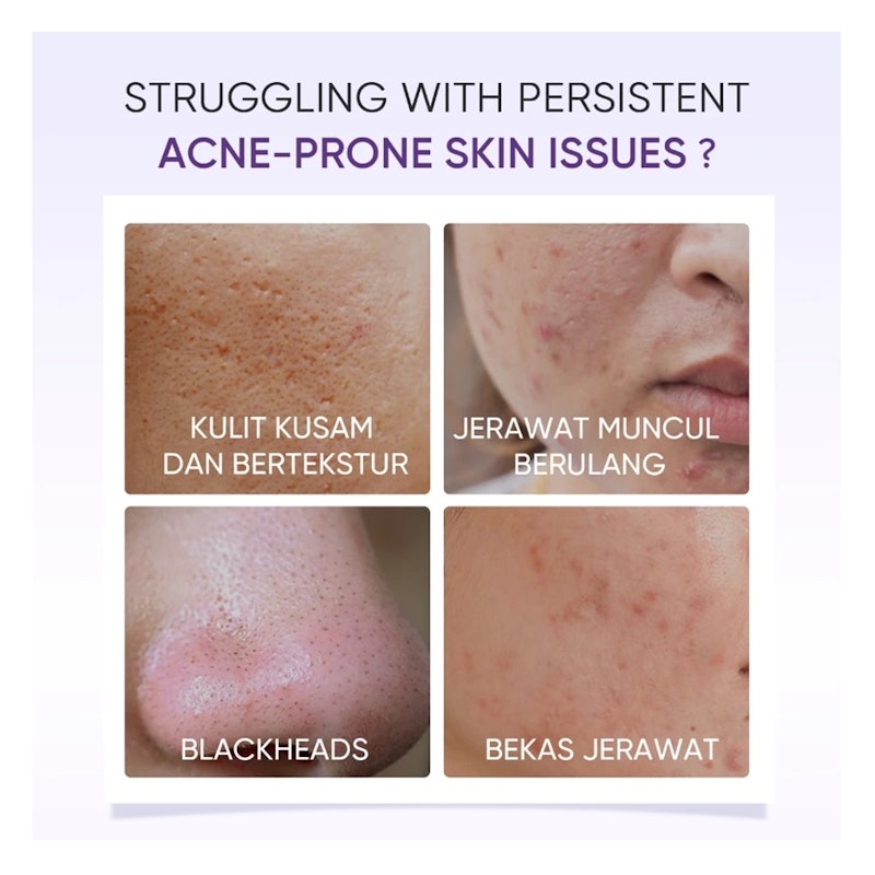 Lactic Acid Skin Renewal Exfoliating Serum 3