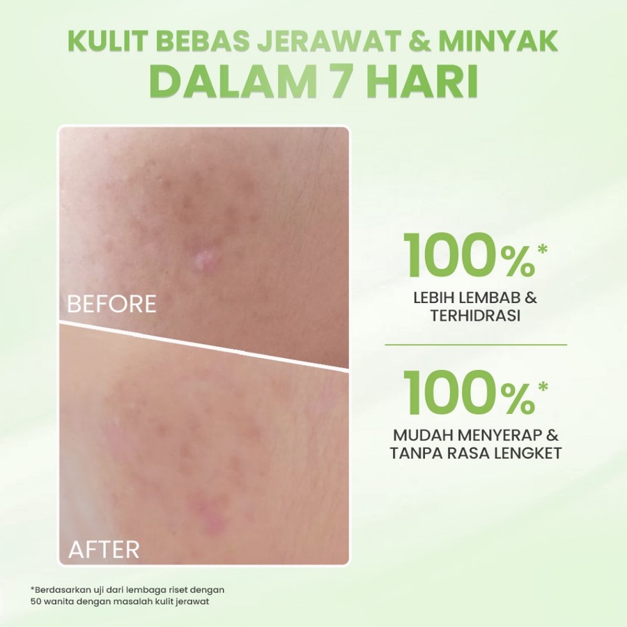 Eka Jaya Internasional Hanasui Acne Expert Night Cream