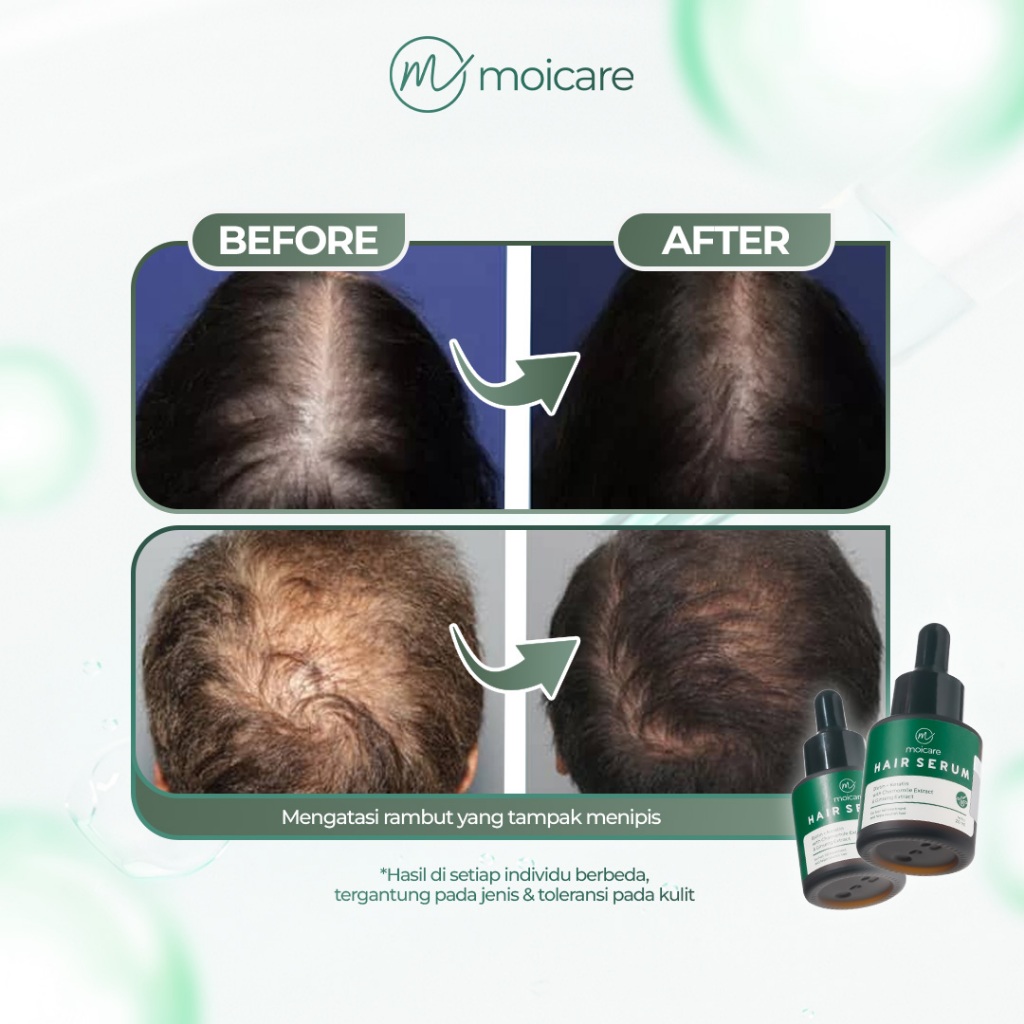 Moicare Hair Serum