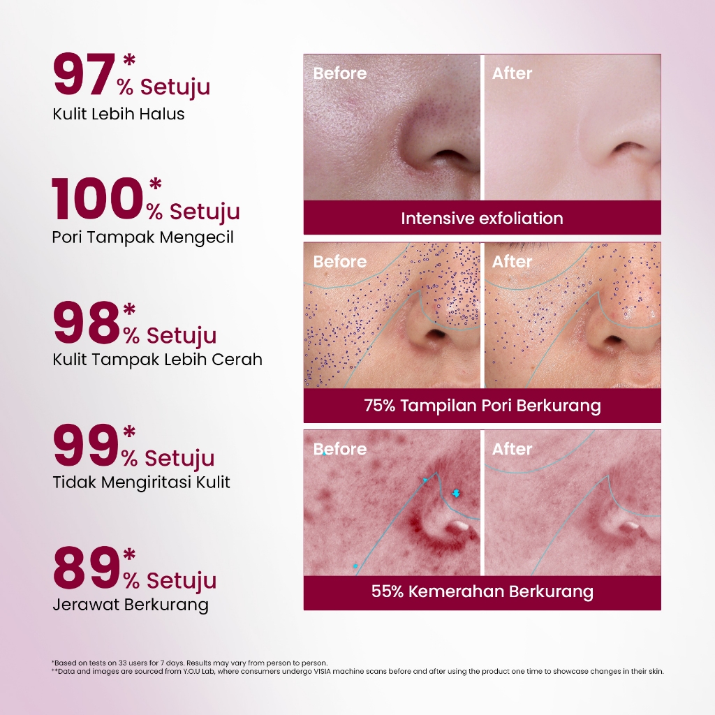 HEBE Beauty Style Y.O.U 12% Acid Intensive Peeling Serum