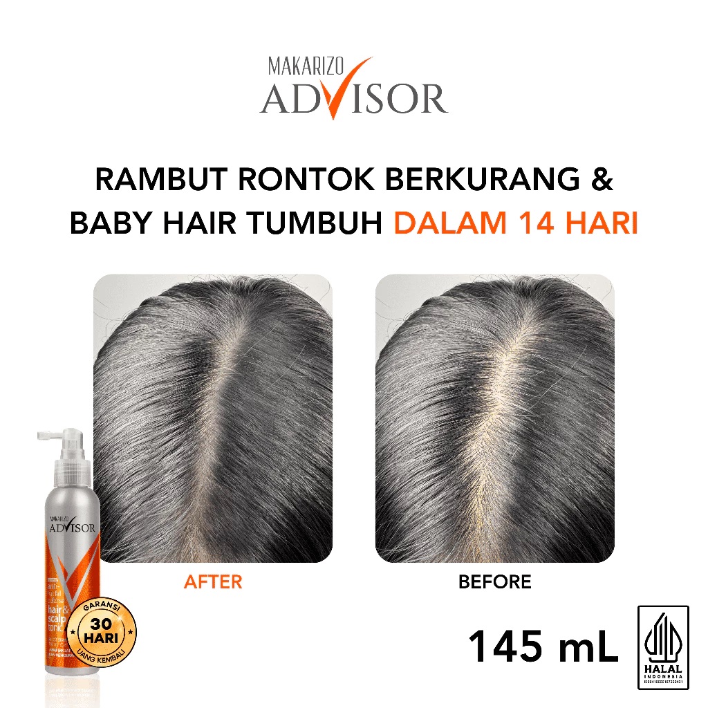 Akasha Wira International Makarizo Advisor Hair & Scalp Tonic