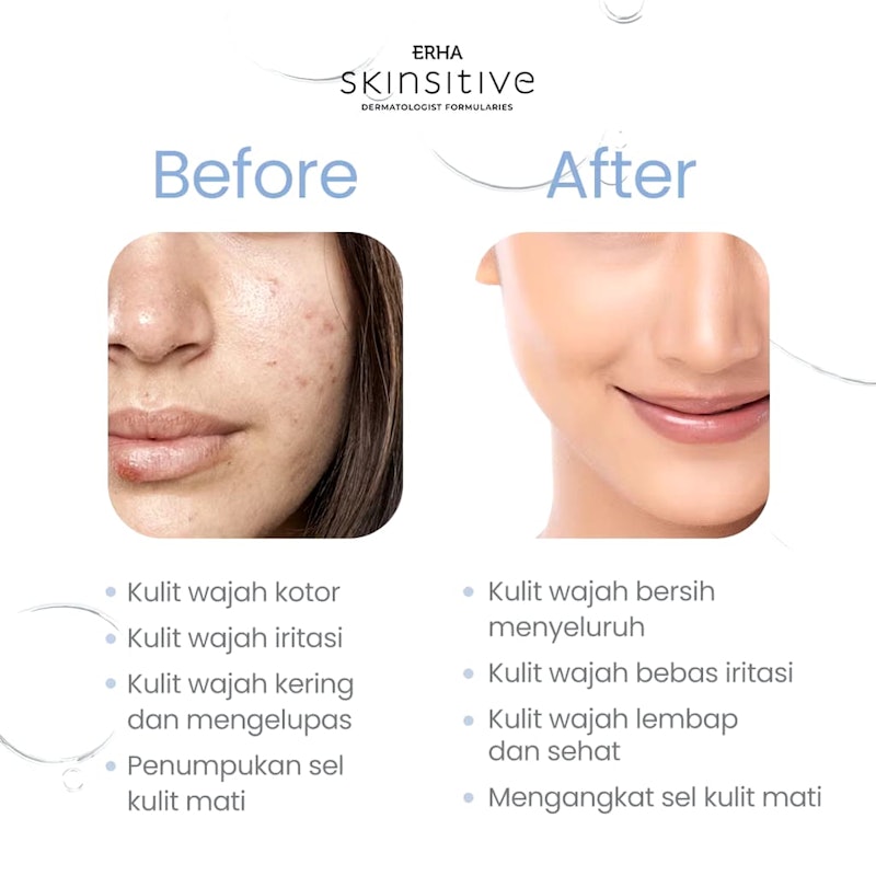 Skinsitive Ultracalm Face Wash 3