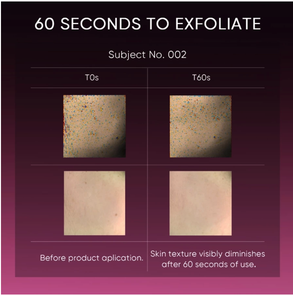 SKINTIFIC Cosmetics SKINTIFIC 12% AHA BHA PHA LHA Peeling Solution