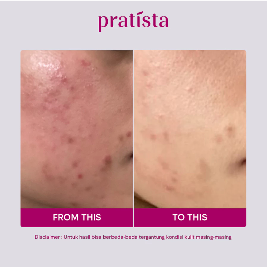 Pratista Citra Nusantara Pratista Calming Spray