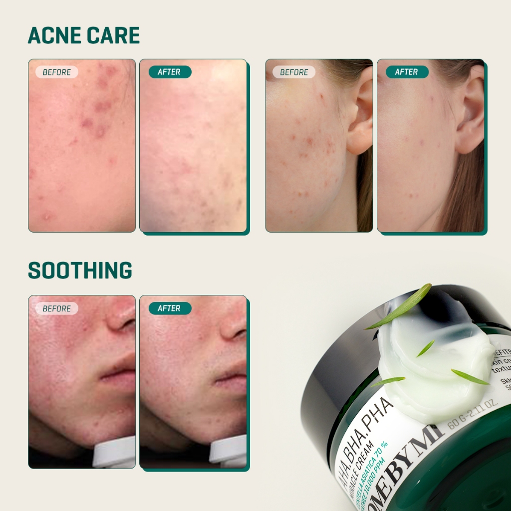 Perennebell SOME BY MI AHA.BHA.PHA 30 Days Miracle Cream