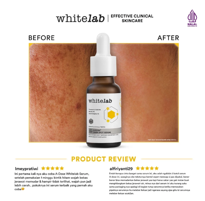 Natura Deca Kosmetika Whitelab A-Dose+ Glowing Serum