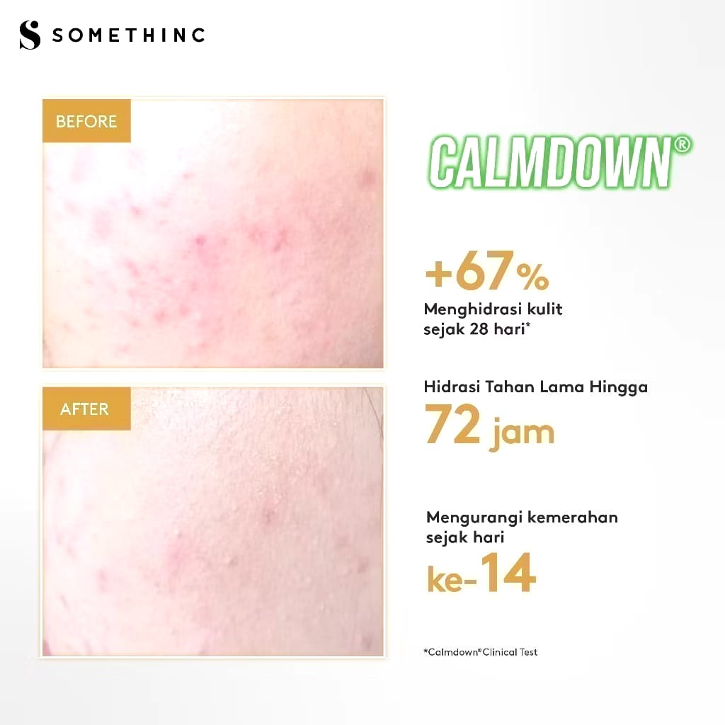 Royal Pesona Indonesia SOMETHINC Calm Down! Skinpair R-Cover Cream