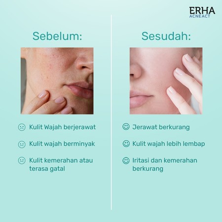 ERHA Clinic Indonesia AcneAct AHA, BHA & Niacinamide Clarifiying Toner