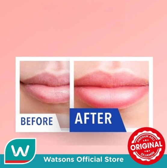 L&P Cosmetic Mediheal Labocare Pantenolips Healbalm 