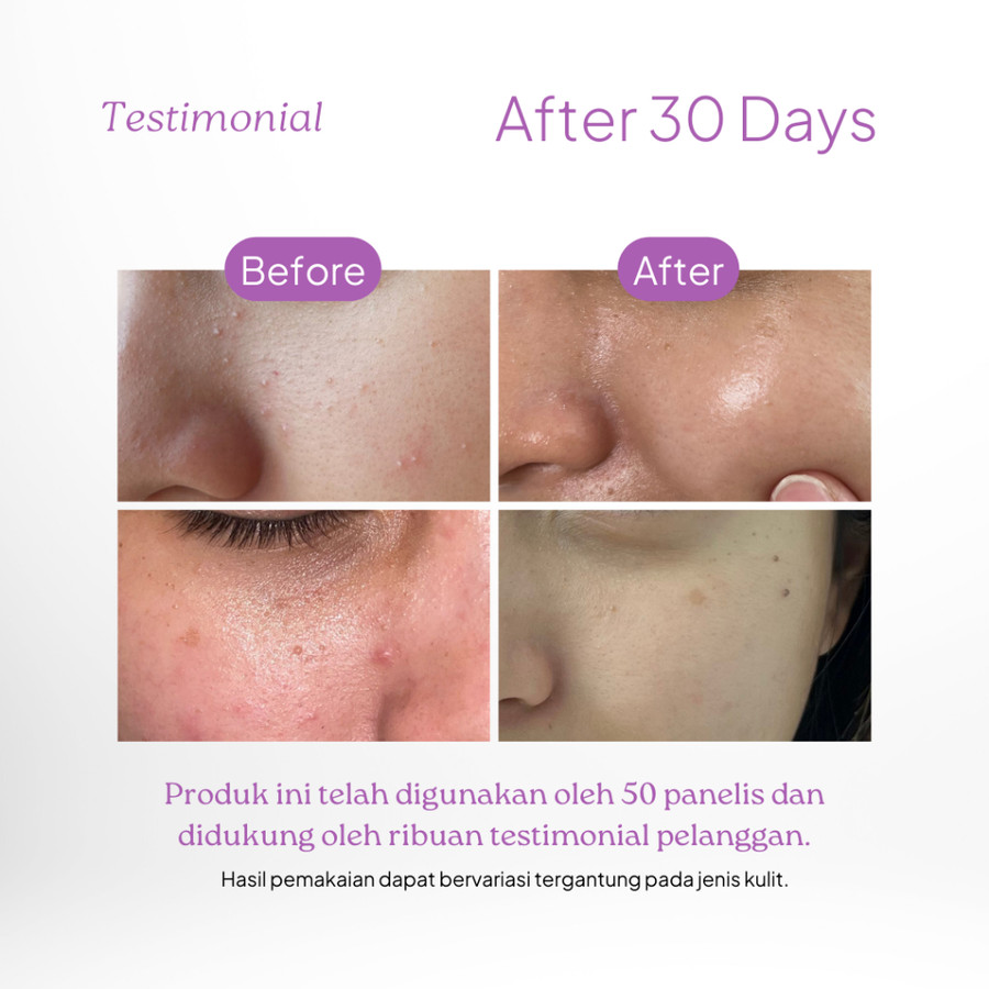 Dorskin Kreasi Indonesia Dörskin Cica Dream Gentle Cleanser