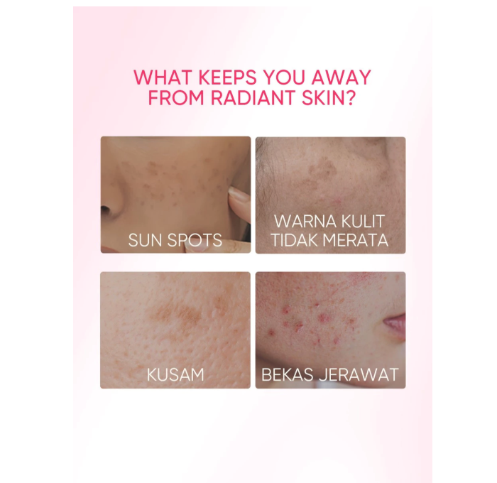 SKINTIFIC Cosmetics SKINTIFIC TXA Niacinamide Brightening Moisture Gel