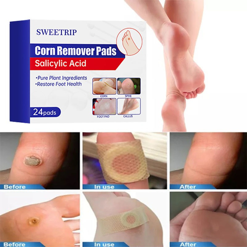 SWEETRIP Corn Removal Pads