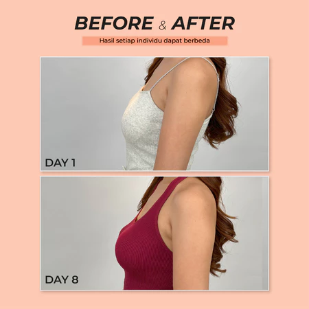  Smart Breast Breast Luxury Cream