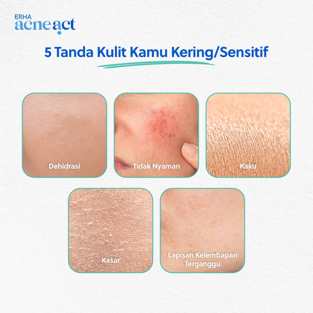 ERHA Clinic Indonesia AcneAct Witch Hazel & BHA Gentle Acne Facial Wash