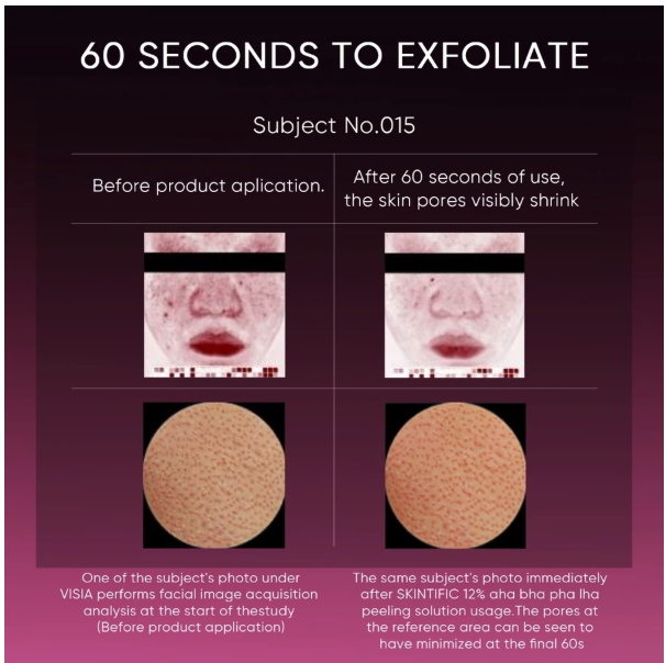 SKINTIFIC Cosmetics SKINTIFIC 12% AHA BHA PHA LHA Peeling Solution